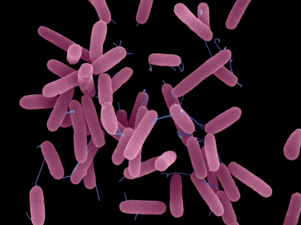 Pseudomonas_aeruginosa